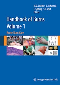 Handbook of Burns Volume 1 -  - E-Book