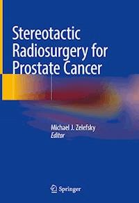 Stereotactic Radiosurgery for Prostate Cancer -  - E-Book