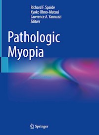 Pathologic Myopia -  - E-Book