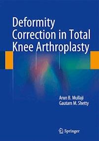 Deformity Correction in Total Knee Arthroplasty - Arun B. Mullaji - E-Book