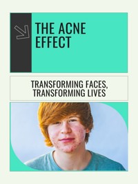 The Acne Effect - Scarlett Y. Turner - E-Book