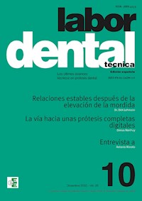 Labor Dental Técnica Nº10 Vol.25 -  - E-Book