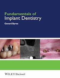 Fundamentals of Implant Dentistry - Gerard Byrne - E-Book