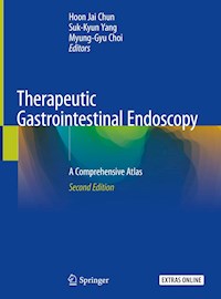 Therapeutic Gastrointestinal Endoscopy - - E-Book