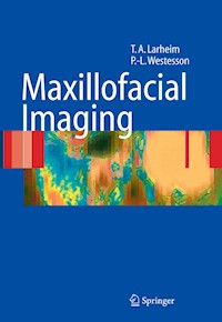 Maxillofacial Imaging - Tore A. Larheim - E-Book