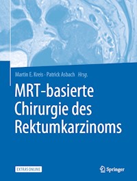 MRT-basierte Chirurgie des Rektumkarzinoms - - E-Book