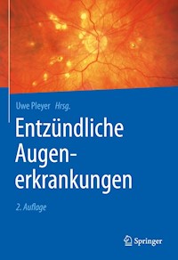 Entzündliche Augenerkrankungen -  - E-Book