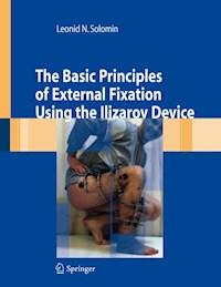 The Basic Principles of External Skeletal Fixation Using the Ilizarov Device - Leonid Solomin - E-Book