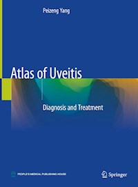 Atlas of Uveitis - Peizeng Yang - E-Book