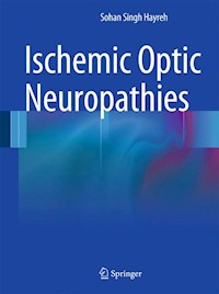 Ischemic Optic Neuropathies - Sohan Singh Hayreh - E-Book