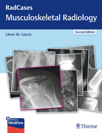 RadCases Q&A Musculoskeletal Radiology -  - E-Book