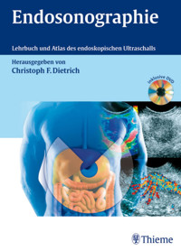 Endosonographie - Christoph Frank Dietrich - E-Book