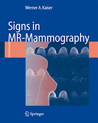 Signs in MR-Mammography - Werner A. Kaiser - E-Book