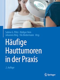 Häufige Hauttumoren in der Praxis - - E-Book