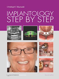 Implantology Step by Step - Christoph T. Sliwowski - E-Book