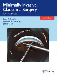 Minimally Invasive Glaucoma Surgery - Brian Francis - E-Book