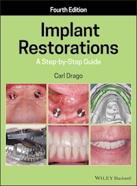 Implant Restorations - Carl Drago - E-Book