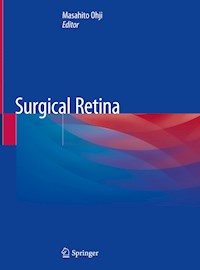 Surgical Retina -  - E-Book