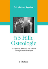 55 Fälle Osteologie -  - E-Book