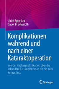 Komplikationen während und nach einer Kataraktoperation - Ulrich Spandau - E-Book