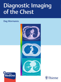 Diagnostic Imaging of the Chest -  - E-Book