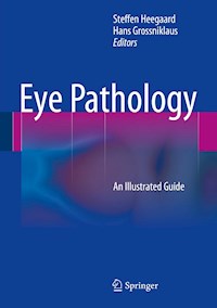 Eye Pathology -  - E-Book