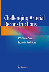 Challenging Arterial Reconstructions - Sachinder Singh Hans - E-Book