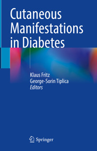 Cutaneous Manifestations in Diabetes -  - E-Book