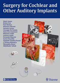 Surgery for Cochlear and Other Auditory Implants - Mario Sanna - E-Book