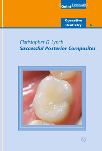 Successful Posterior Composites - Christopher D. Lynch - E-Book