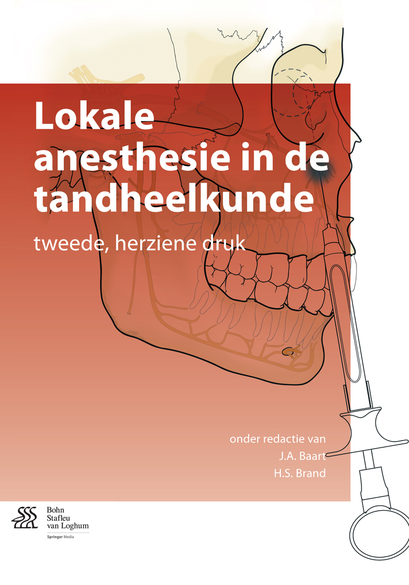 Lokale anesthesie in de tandheelkunde -  - E-Book