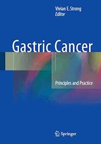 Gastric Cancer -  - E-Book