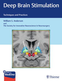 Deep Brain Stimulation - William S. Anderson - E-Book