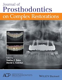 Journal of Prosthodontics on Complex Restorations - - E-Book