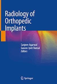 Radiology of Orthopedic Implants -  - E-Book