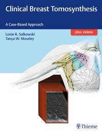 Clinical Breast Tomosynthesis - Lonie R. Salkowski - E-Book