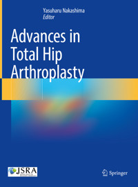 Advances in Total Hip Arthroplasty -  - E-Book