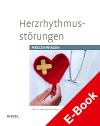 Herzrhythmusstörungen - Matthias Manz - E-Book