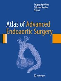 Atlas of Advanced Endoaortic Surgery -  - E-Book