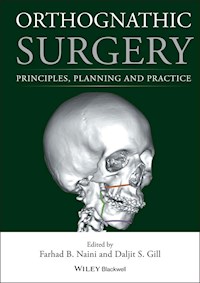 Orthognathic Surgery -  - E-Book