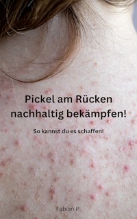 Pickel am Rücken nachhaltig bekämpfen! - Fabian P. - E-Book