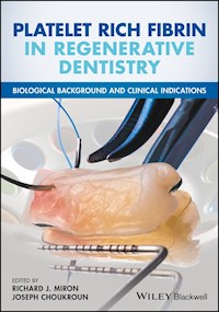 Platelet Rich Fibrin in Regenerative Dentistry -  - E-Book