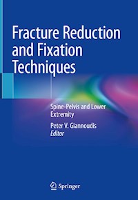 Fracture Reduction and Fixation Techniques -  - E-Book