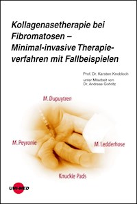 Kollagenasetherapie bei Fibromatosen – Minimal-invasive Therapieverfahren mit Fallbeispielen - Karsten Knobloch - E-Book