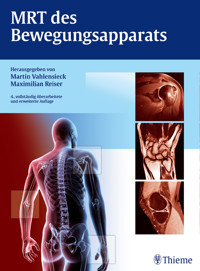 MRT des Bewegungsapparats -  - E-Book