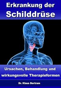 Erkrankung der Schilddrüse – Ursachen, Behandlung und wirkungsvolle Therapieformen - Dr. Klaus Bertram - E-Book
