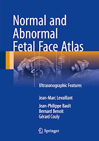 Normal and Abnormal Fetal Face Atlas - Jean-Marc Levaillant - E-Book