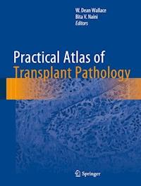 Practical Atlas of Transplant Pathology -  - E-Book