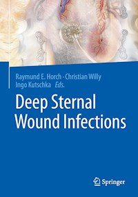 Deep Sternal Wound Infections -  - E-Book