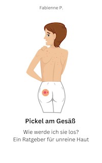 Pickel am Gesäß - Fabienne P. - E-Book